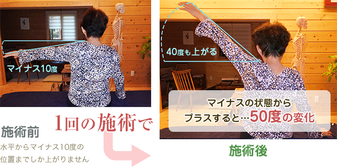 N.T様(女性:76才)