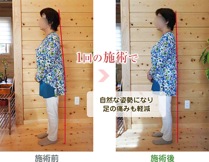 E.M様(女性:67才)